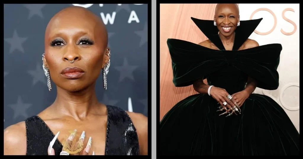 why is cynthia erivo bald