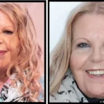 Sally Thomsett Face Illness
